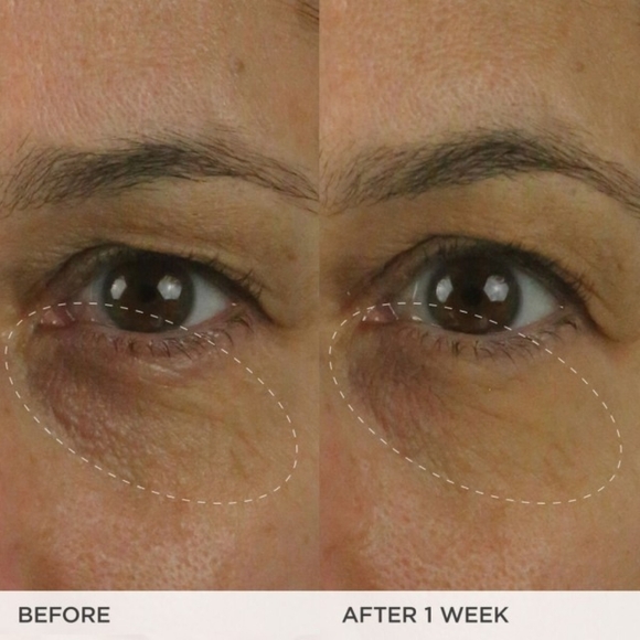 Tatcha Brightening Eye Cream - Buy 1 GET 1 FREE! - Picture 8 of 15